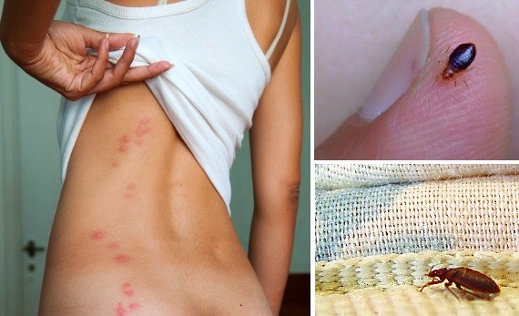 Bed Bug Treatment CT 5