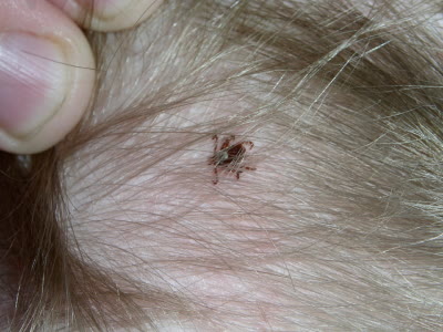 Tick Control & Prevention CT 2